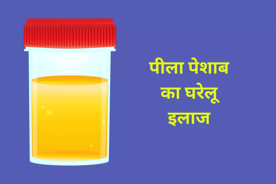 पीला पेशाब का घरेलू इलाज