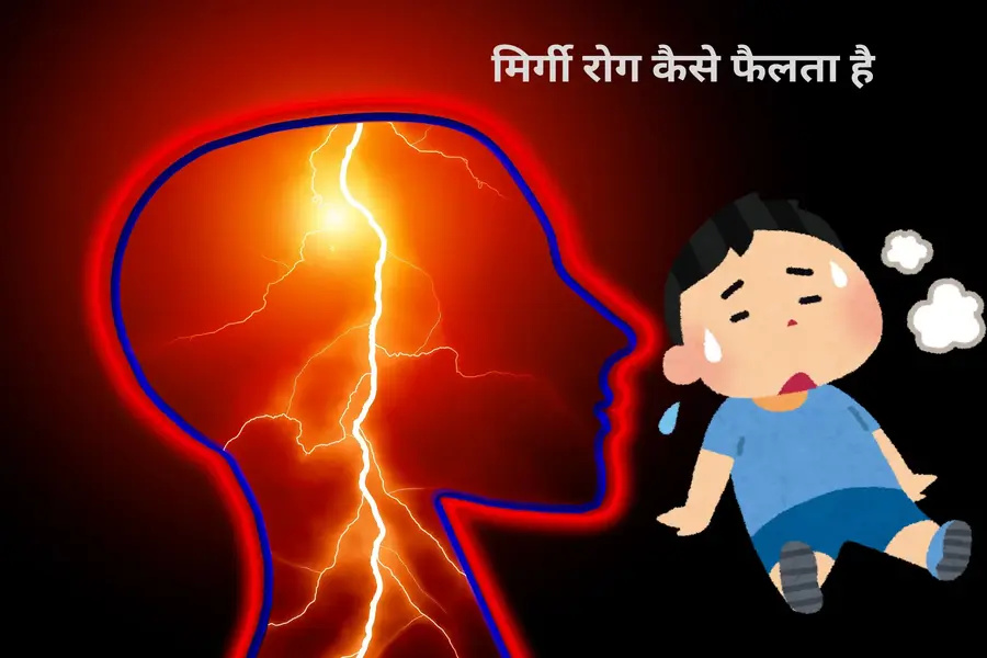 मिर्गी रोग कैसे फैलता है